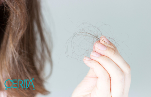 درمان ریزش مو با شامپو ضد ریزش
